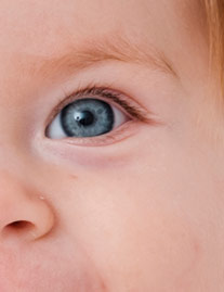 RETINOPATIA PREMATURIDADE